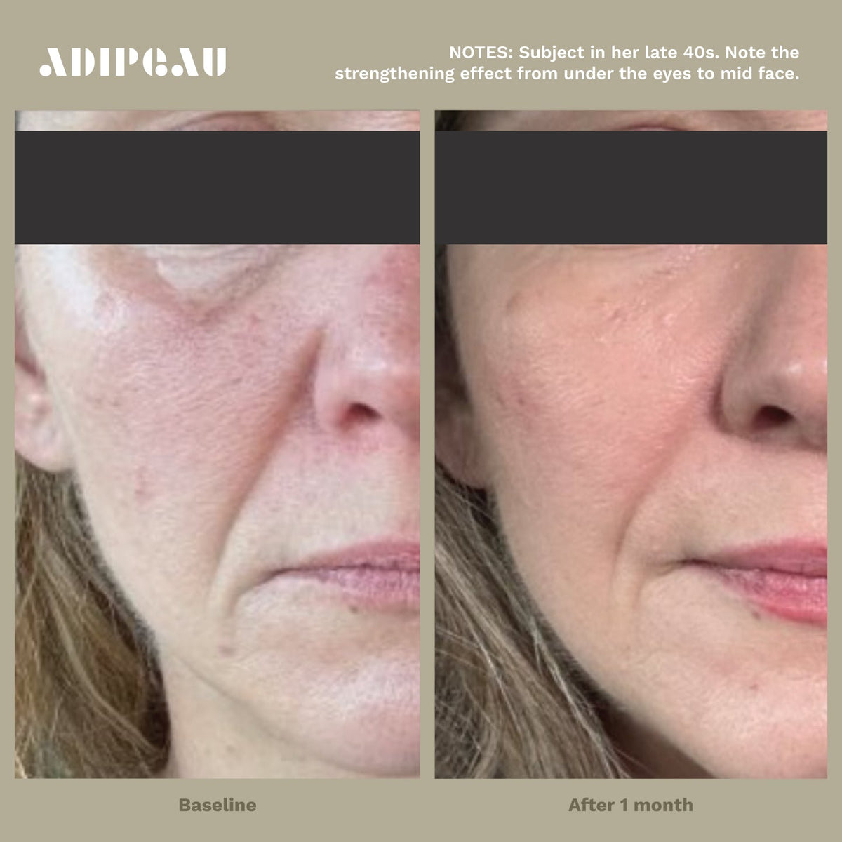 Adipeau Strong Body Gel, view 2
